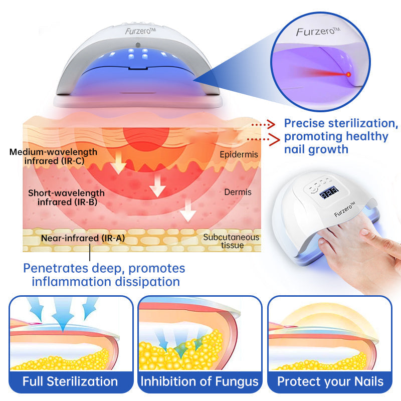 Furzero™ Pure-Nail Fungus Laser Therapy Device